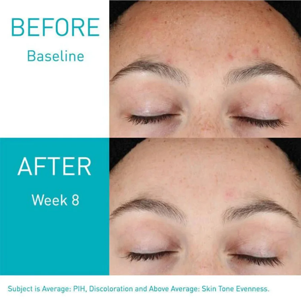 CeraVe Resurfacing Retinol Serum 30ml Info graphics CeraVe Resurfacing Retinol Serum 30ml Info graphics