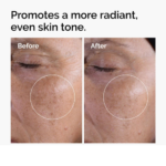 The Ordinary Glycolic Acid 7% Toning Solution