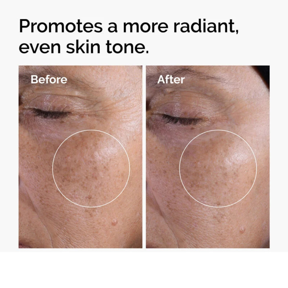 The Ordinary Glycolic Acid 7% Toning Solution The Ordinary Glycolic Acid 7% Toning Solution