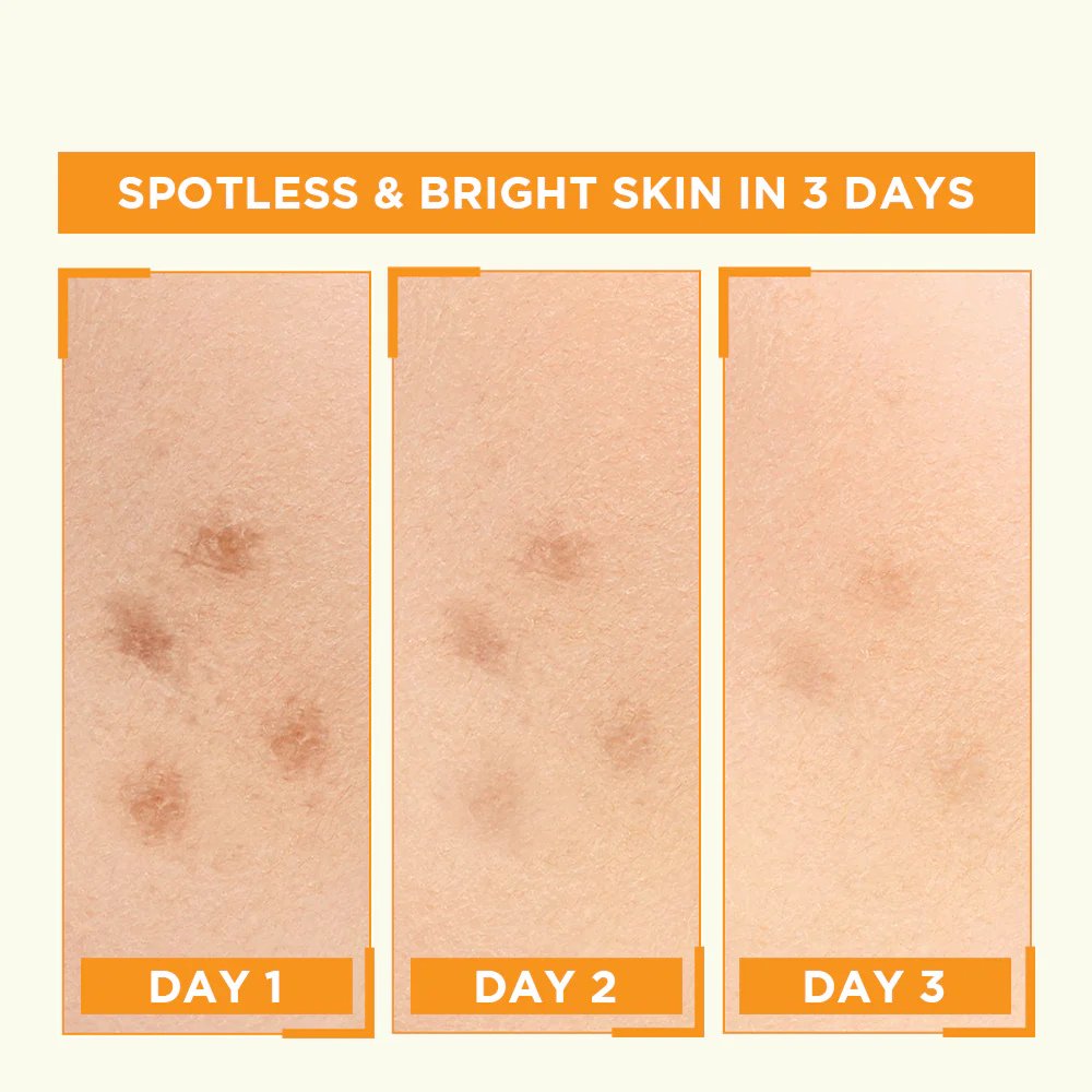 Garnier Bright Complete Vitamin C Booster Serum - 30ml - Result Graphics Garnier Bright Complete Vitamin C Booster Serum - 30ml - Result Graphics