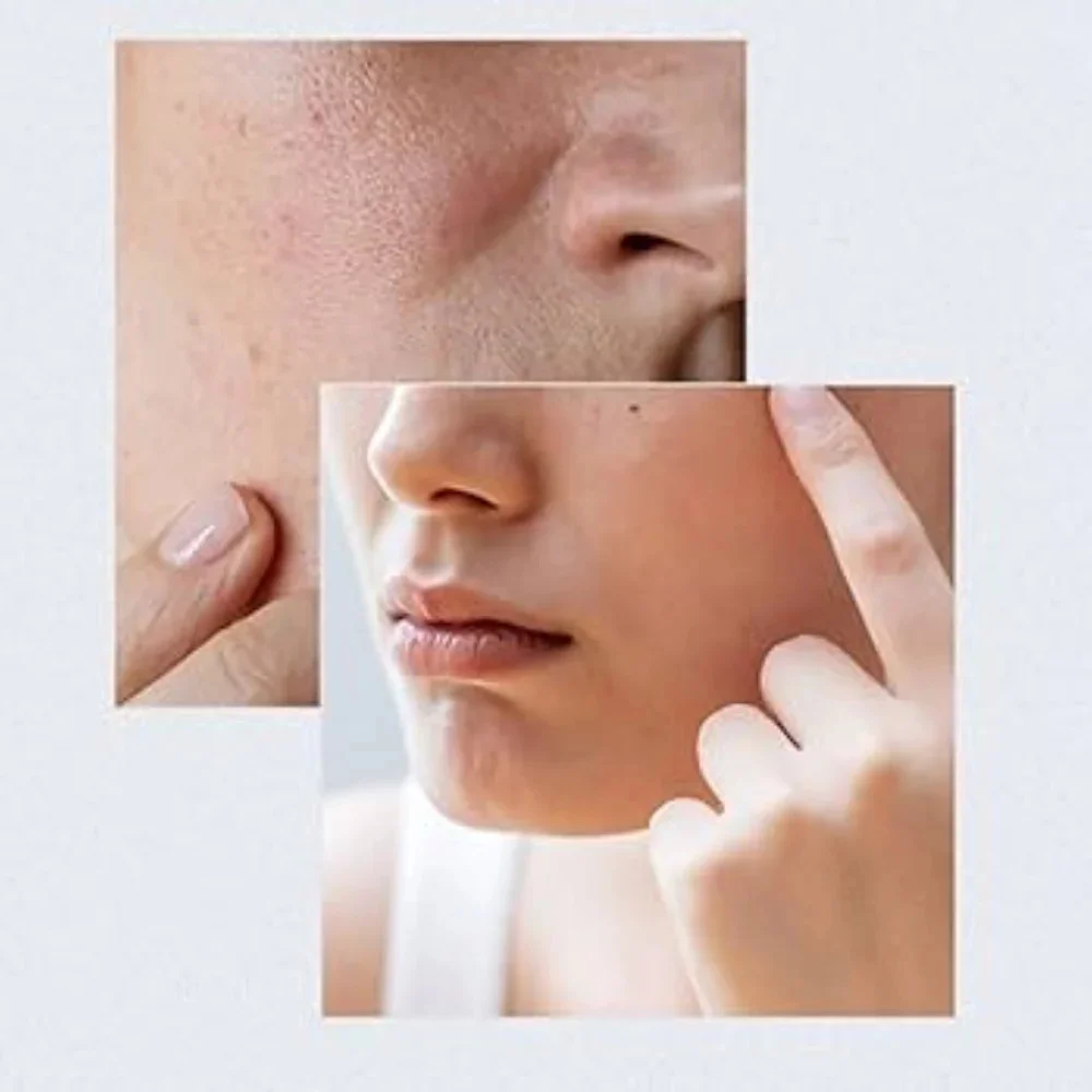 ANUA Birch Moisture Boosting Serum 30ml ANUA Birch Moisture Boosting Serum 30ml