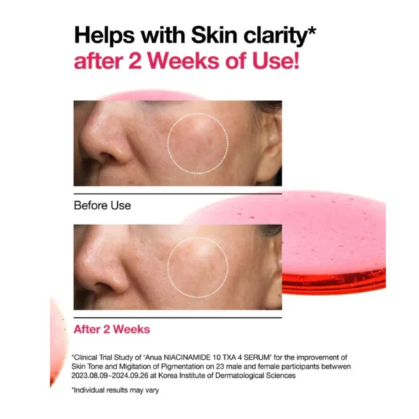 ANUA Niacinamide 10% + TXA 4% Serum 30ml