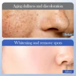 SADOER Whitening Spot Removing 5 Piece Set Nourishing and Moisturizing Skincare