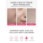 KORMESIC Lightening Face Whitening Cream Kojic Acid Collagen Face Cream