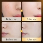 ZOZU 24K GOLD HYALURONIC ACID MOIST REPAIR ESSENCE 30ML