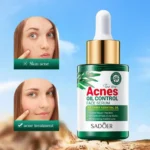 Sadoer Tea Tree Acnes Face Serum