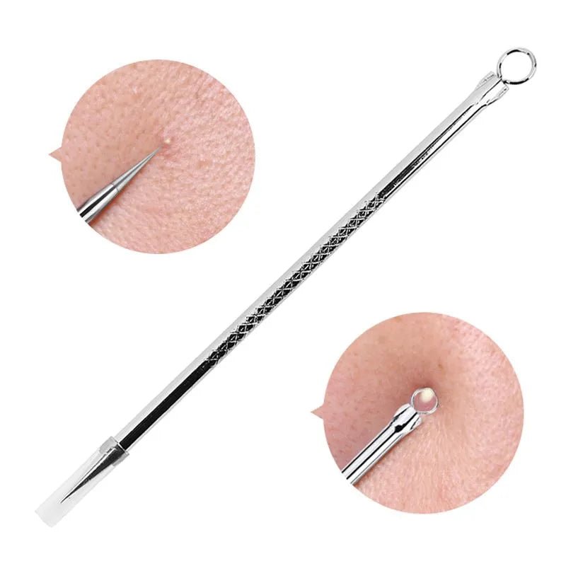 (1 Pc) Blackhead Remover Pin Needle Extractor Acne Pimple Cleaning Tool Black Head Removal Stainless Steel Stick – Whitehead Blackhead Remover Pin